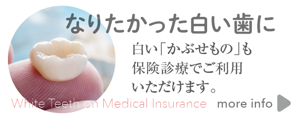 なりたかった白い歯に - 白い「かぶせもの」も保険診療でご利用いただけます。